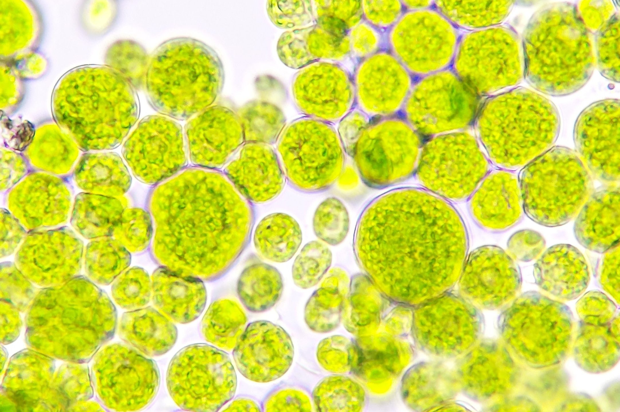 Algae blooming under light microscope